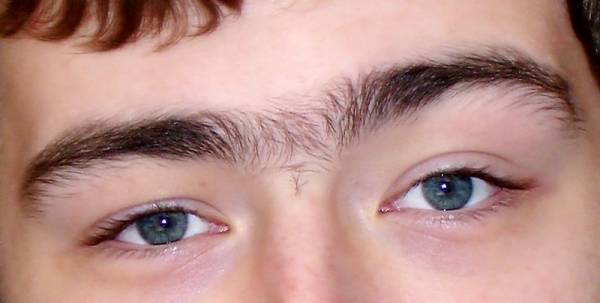 unibrow